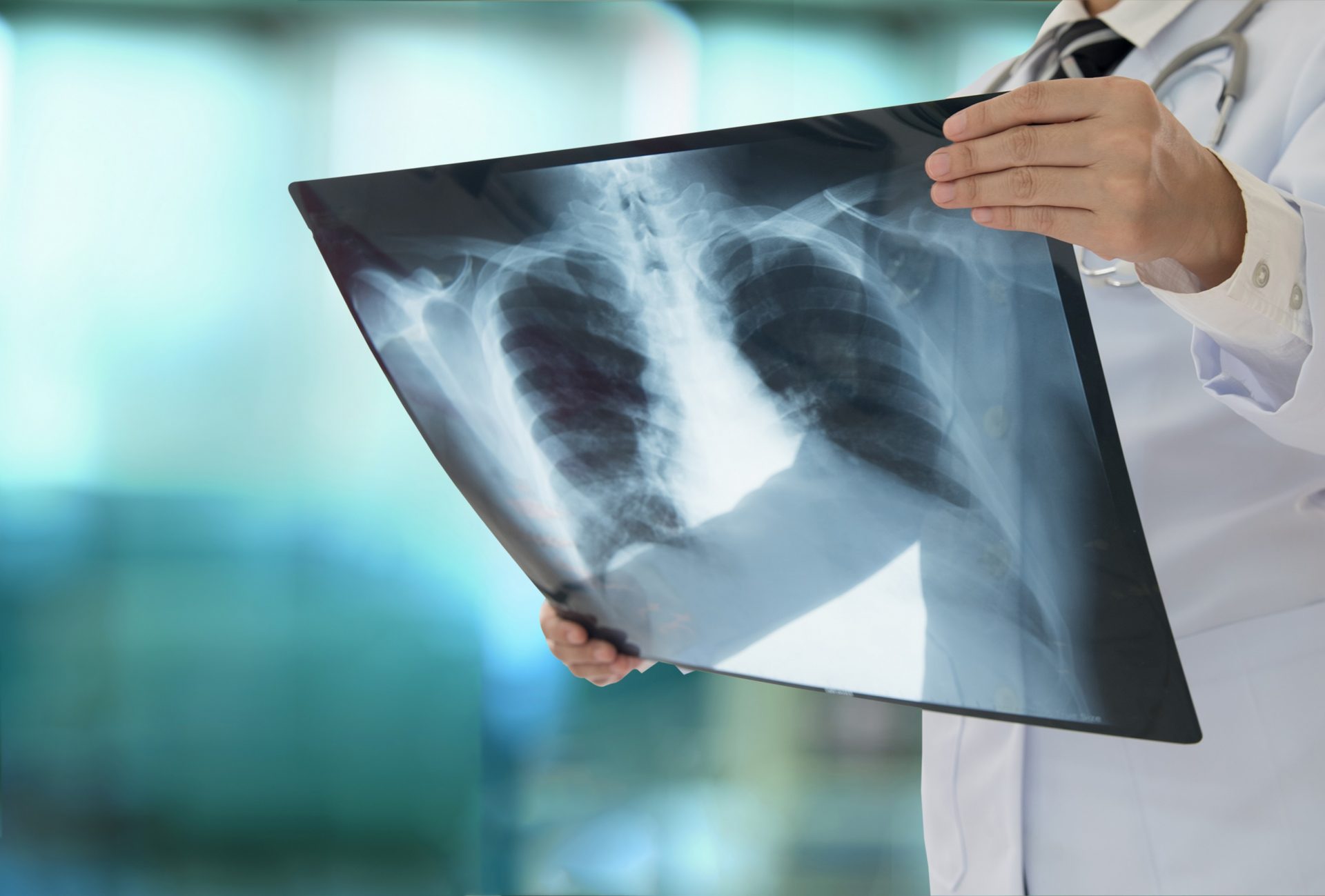 Radiografie Pitești, Argeș