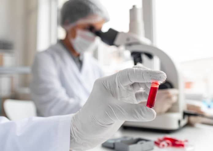 Care-sunt-cel-mai-des-intalnite-tipuri-de-anemie-doi-medici-mana-eppendorf-cu-proba-de-sange-in-fundal-un-medic-analizand-proba-la-microscop Care-sunt-cel-mai-des-intalnite-tipuri-de-anemie-doi-medici-mana-eppendorf-cu-proba-de-sange-in-fundal-un-medic-analizand-proba-la-microscop
