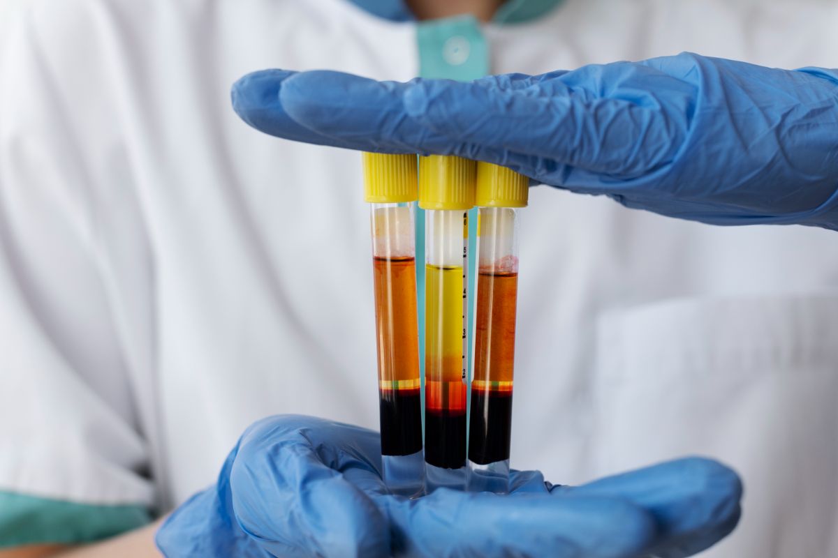 -Infiltratie-cu-plasma-–-medic-manusi-albastre-trei-vacutainere-cu-plasma -Infiltratie-cu-plasma-–-medic-manusi-albastre-trei-vacutainere-cu-plasma