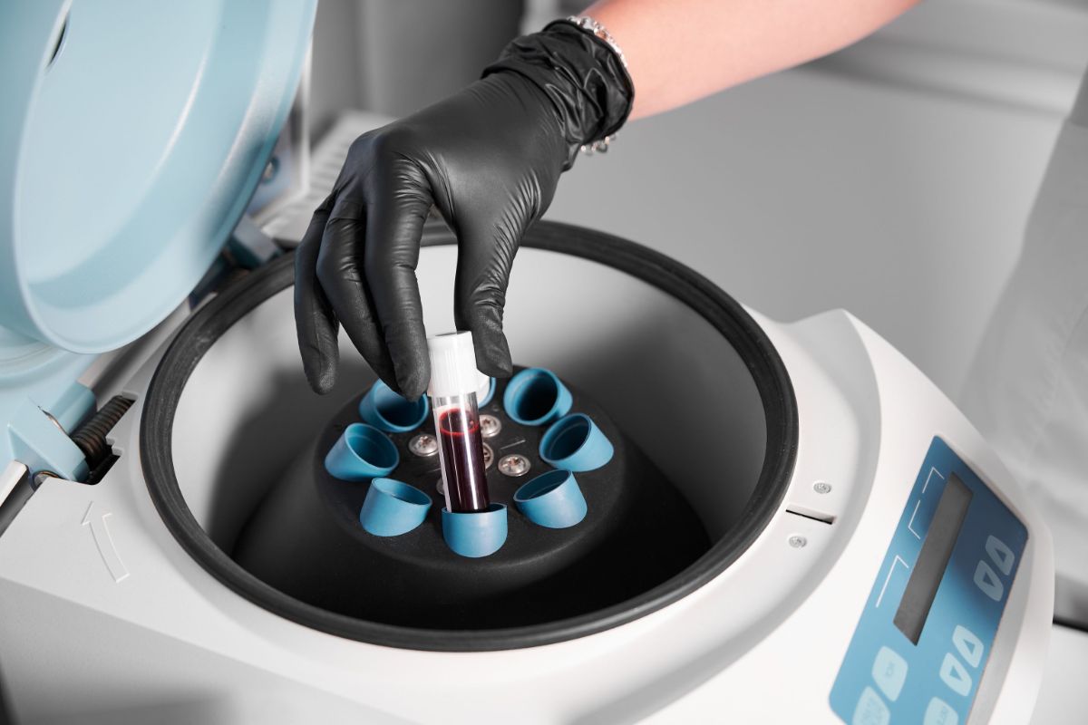 Infiltratii-cu-plasma-la-genunchi-–-centrifugare-vacutainere-sange. Infiltratii-cu-plasma-la-genunchi-–-centrifugare-vacutainere-sange.